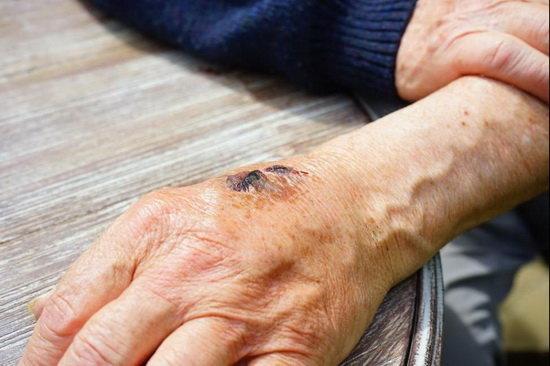 راهکاری جدید برای مقابله با باکتری های مقاوم در برابر آنتی بیوتیک
