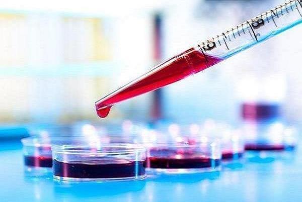 شناسایی سریع آلزایمر با آزمایش خون هوش مصنوعی شناسایی سریع آلزایمر با آزمایش خون هوش مصنوعی