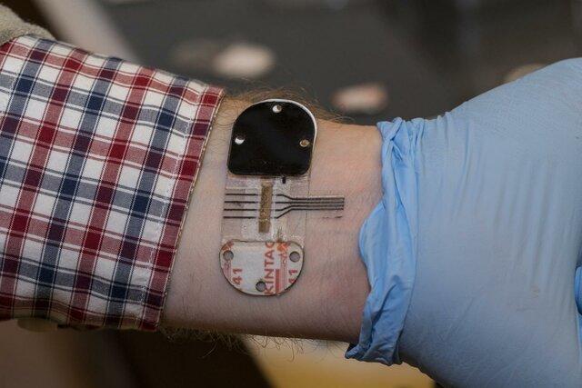 آزمایش عرق بدن جایگزین آزمایش خون می شود