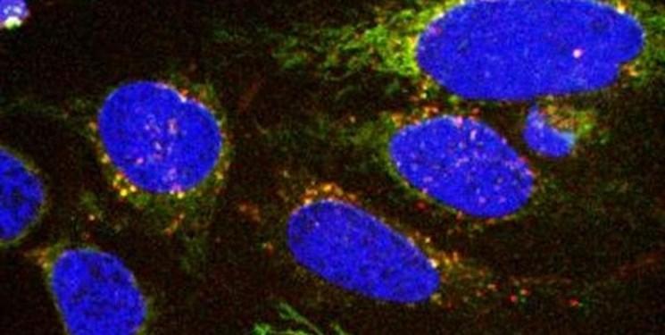 آنالیز تغییرات تغذیه سلول ها، راهی برای تشخیص سرطان