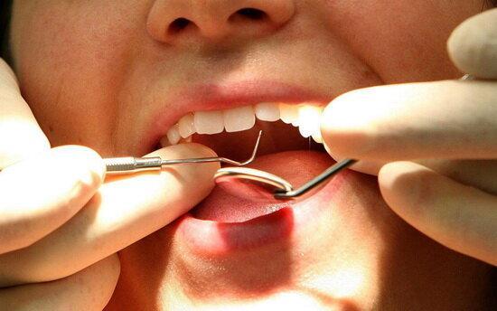 هر 3 سال یک دندان پوسیده به دهان ایرانیان اضافه می گردد