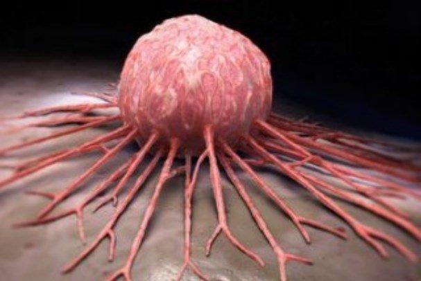 ابداع لیزری که سلول های سرطانی را در خون ردیابی می نماید