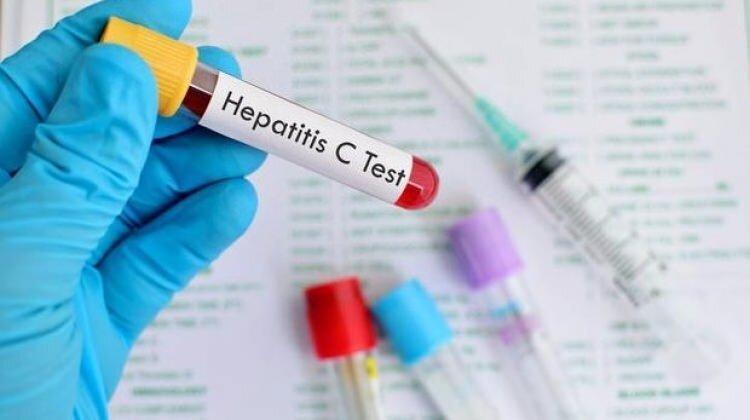 مبتلایان به هپاتیت سی چه رژیم غذایی باید داشته باشند؟