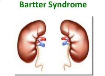 علائم یک سندرم کلیوی
