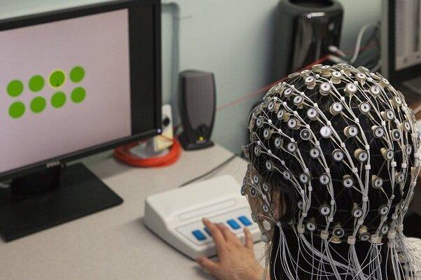 رقابت محققان برای ساخت سیستم تحریک غیرتهاجمی مغز