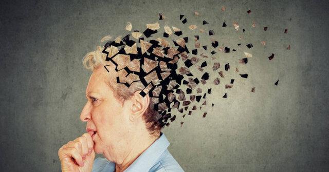 چرت زدن بیش از حد می تواند از نشانه های آلزایمر باشد