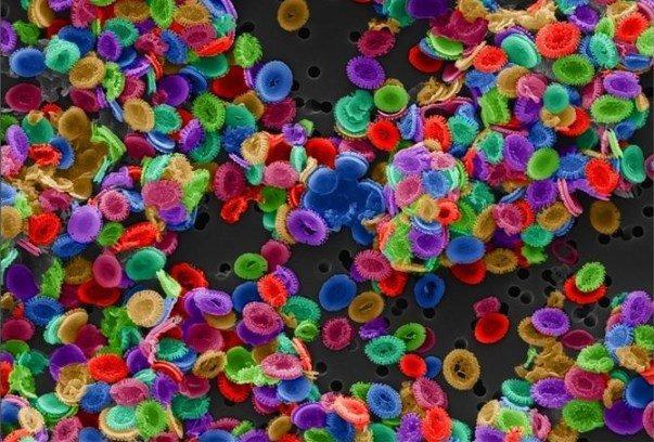 ساخت ایمپلنتی کاشتنی در شریان های حساس بدن