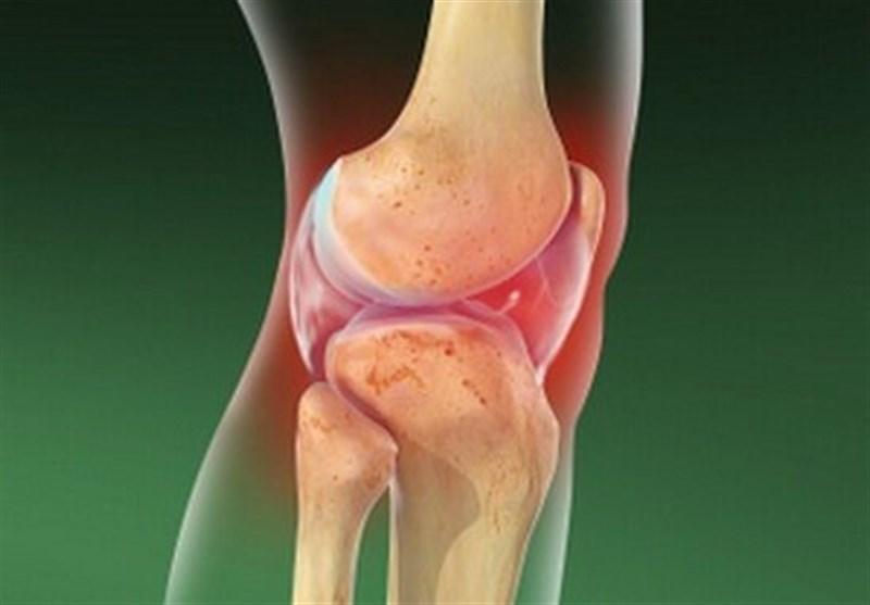 آرتریت سپتیک چیست و چه علائمی دارد؟