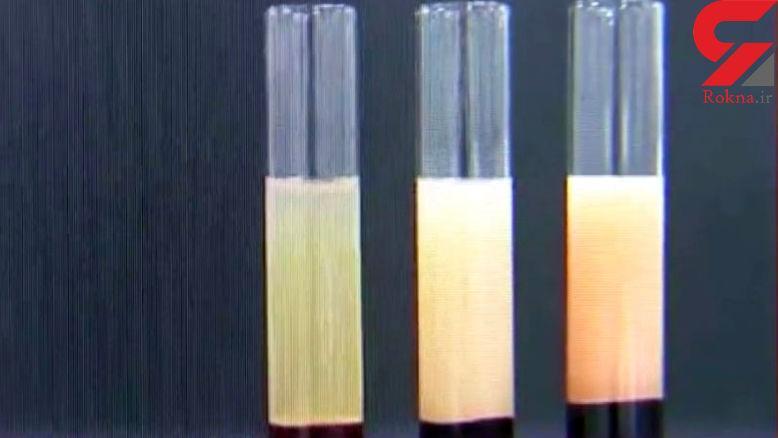 مردی که خون سفید در رگ هایش جریان دارد!