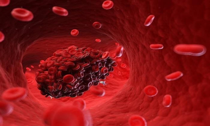 15 نشانه ترسناک وجود لخته خون در بدن