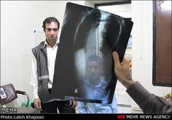 سندرم گیرکردن شانه یکی از شایع ترین مسائل ارتوپدی