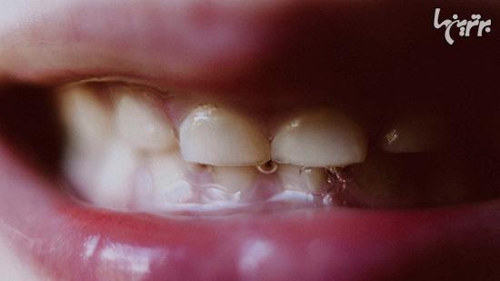 حقایقی درباره دهان که نمی دانستید