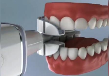 جذاب ترین نسل از مسواک شارژی