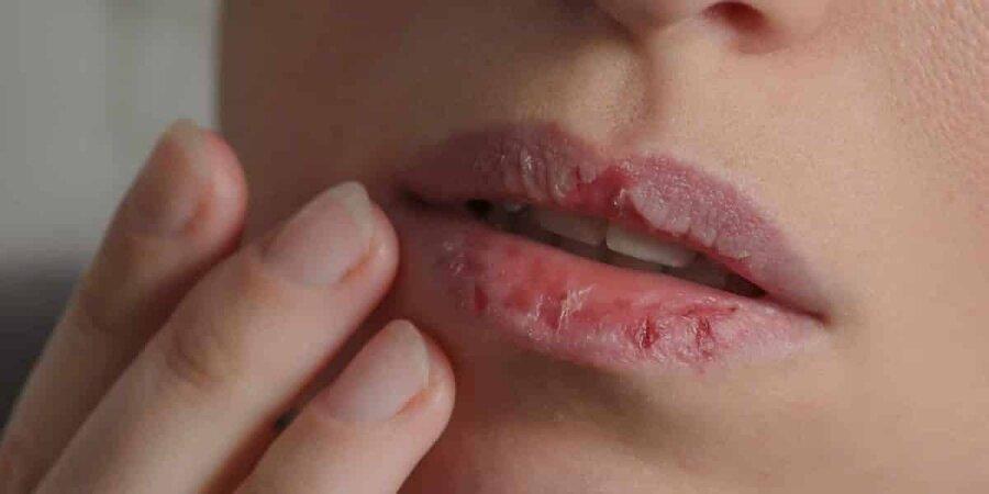 نکته بهداشتی ، با پوست تان ور نروید