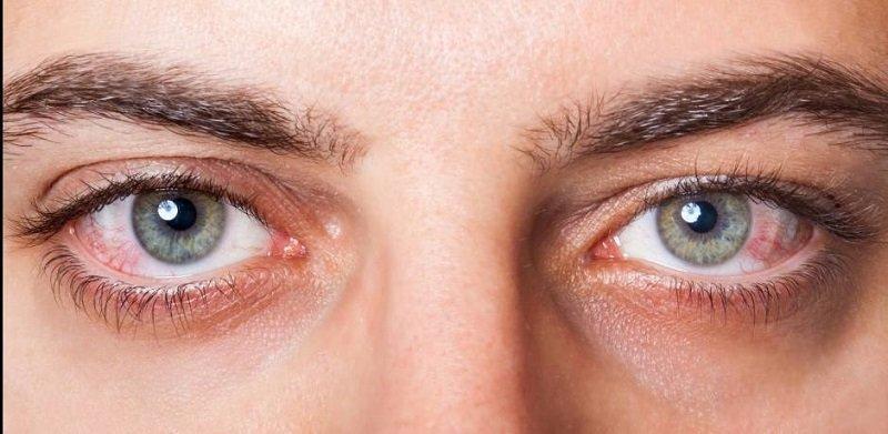 مروارید که با افزایش سن نمایان می شود