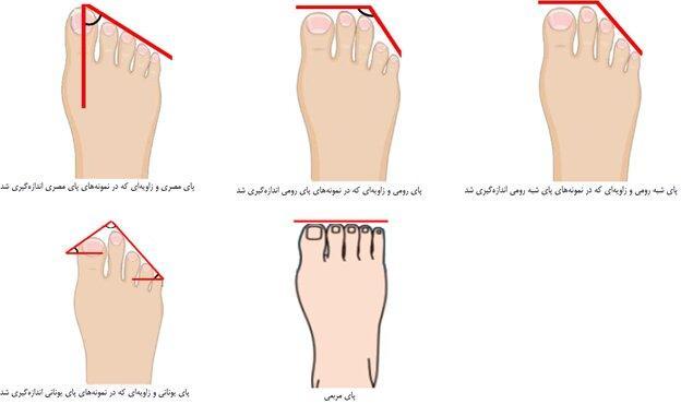 پای ایرانیان چه شکلی است؟ عکس پای ایرانیان چه شکلی است؟