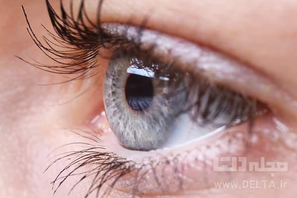 تاری دید چشم و علل آن تاری دید چشم و علل آن