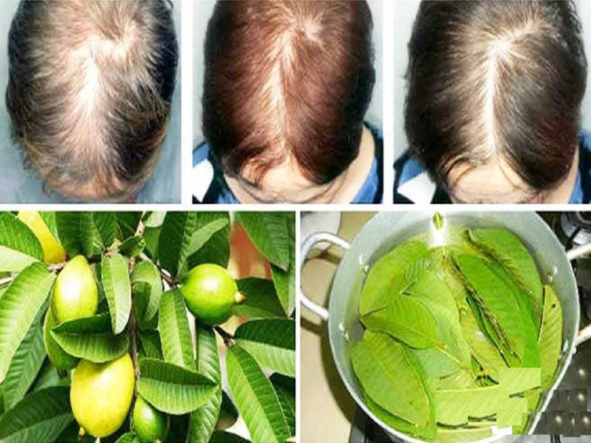 با برگ های این درخت ریزش مو را متوقف کنید