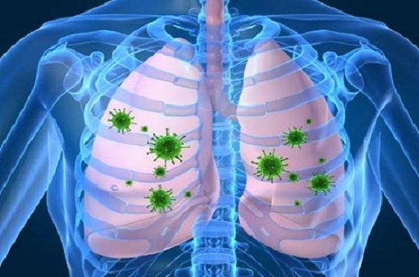 افزایش خطر انسداد مزمن ریوی در مبتلایان بهHIV
