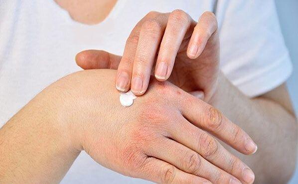 چگونه خشکی پوست دست را رفع کنیم؟