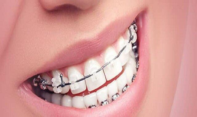 خدمات ارتودنسی را از متخصصان دریافت کنید خدمات ارتودنسی را از متخصصان دریافت کنید
