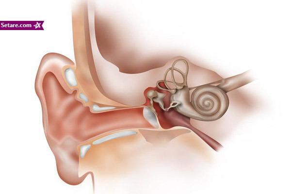 بیماری اتواسکلروز چیست؟