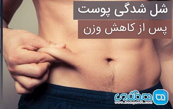 6 راه برای سفت کردن پوست بعد از کاهش وزن