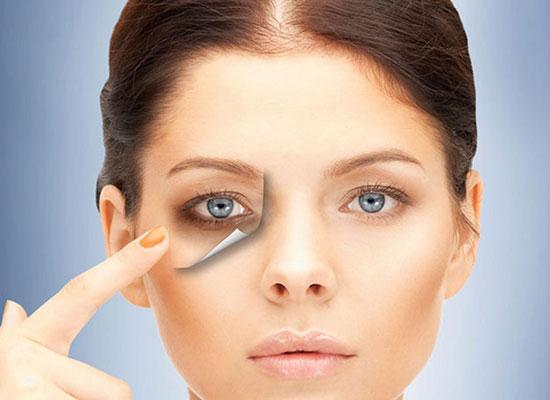 کربوکسی تراپی؛ روشی برای برطرف سیاهی دور چشم