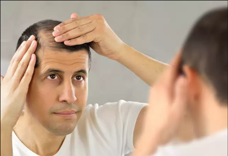 علت ریزش مو در مردان چیست و چگونه درمان می گردد؟