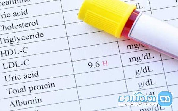 خوراکی های ممنوع در زمان اسید اوریک بالا