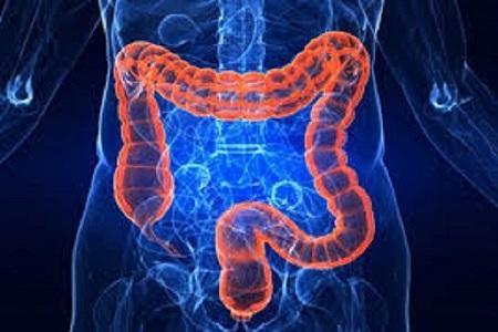 سو جذب روده باعث چه بیماری هایی می گردد؟