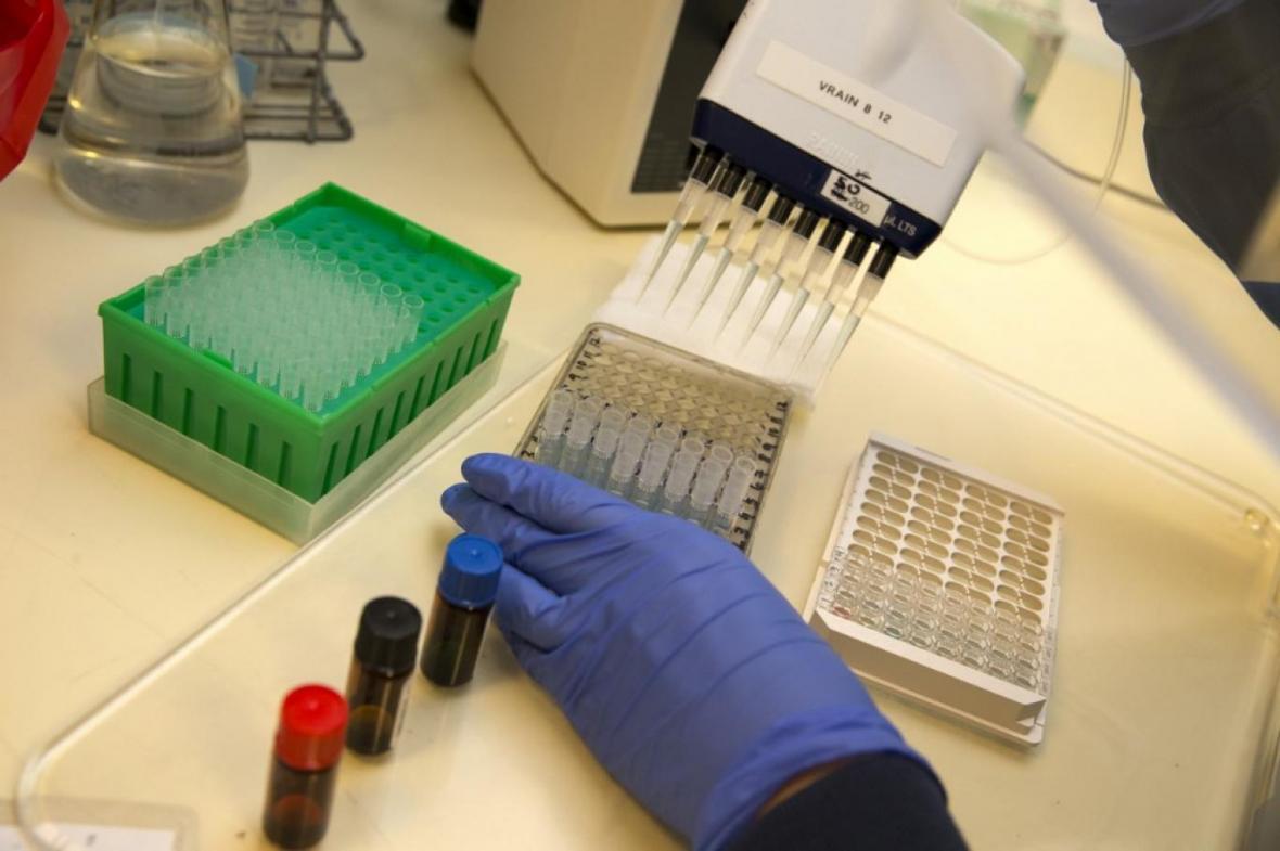 آزمایش لنفوسیت های تی موثرتر از تست پادتن