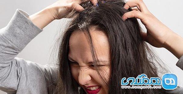 5 روش خانگی و در دسترس برای درمان فوری و ساده شپش سر