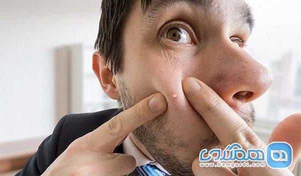 چرا جوش می زنیم و چگونه درمانش کنیم؟