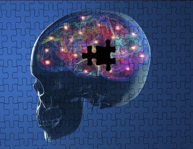کاهش درد ناشی از پارکینسون با تحریک الکتریکی نخاع