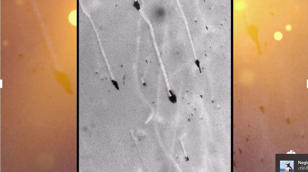 روبات های جوانه چای به جنگ باکتری ها می فرایند ، فناوری نوین برای ایمپلنت ها