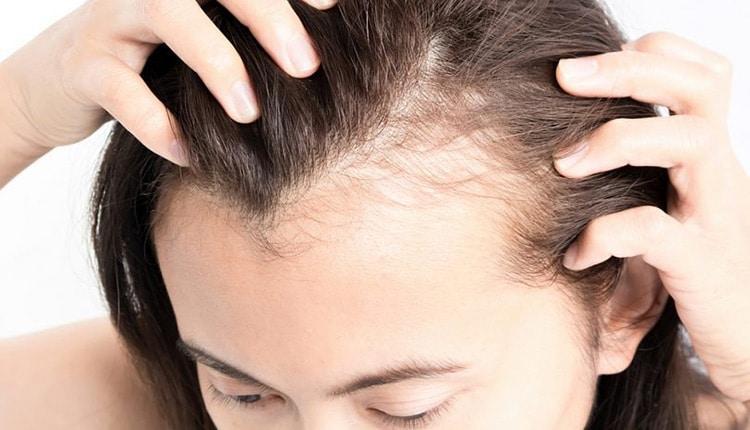 درمان طبیعی ریزش مو با جادوی گیاهان و مواد دارویی