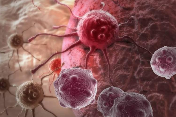 نانوذرات RNA برای مقابله با سرطان موثرتر هستند نانوذرات RNA برای مقابله با سرطان موثرتر هستند