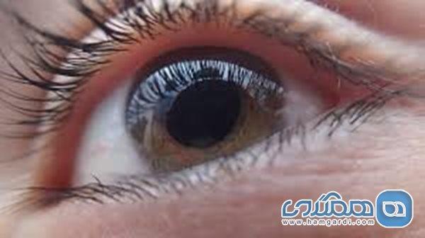 اگر با نور مشکل دارید به این بیماری خطرناک مبتلا هستید اگر با نور مشکل دارید به این بیماری خطرناک مبتلا هستید