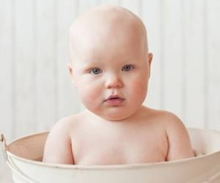 موی کودک شما کم پشت است؟