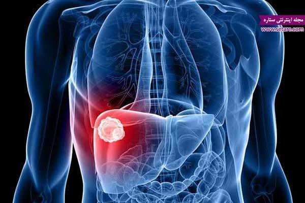 خطرناکترین نوع بیماری هپاتیت چیست؟