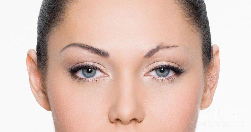 مهم ترین علل ریزش مو ابرو