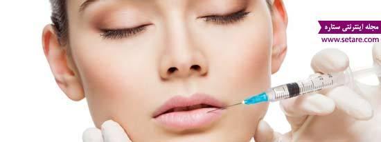 عوارض پروتز لب و تزریق ژل به لب چیست؟