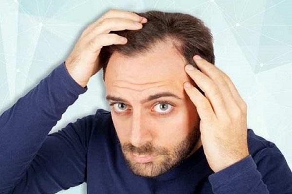 چند توصیه طلایی برای مراقبت از مو ها در فصل سرما