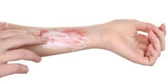 درمان فوری سوختگی درمان فوری سوختگی