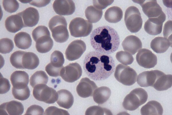 کشف پروتئینی که خون را جوان و سالم می نماید