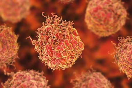 روش جدید یک ایرانی برای درمان سرطان