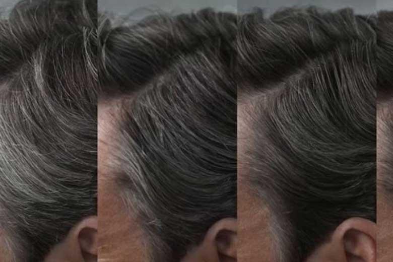 روش هایی برای نداشتن مو های سفید