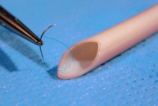 آنالیز جریان خون در عروق برای ساخت رگ های مصنوعی