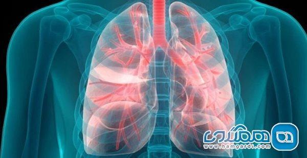 دلایل اصلی ابتلا به ذات الریه و چگونگی پیشگیری از آن دلایل اصلی ابتلا به ذات الریه و چگونگی پیشگیری از آن
